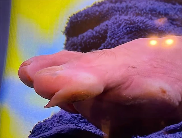 Close -up of Djokovic's horrific wounds