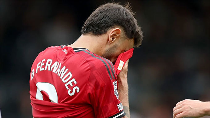 Many MU fans want Ruben Amorim to eliminate Bruno Fernandes from the squad.